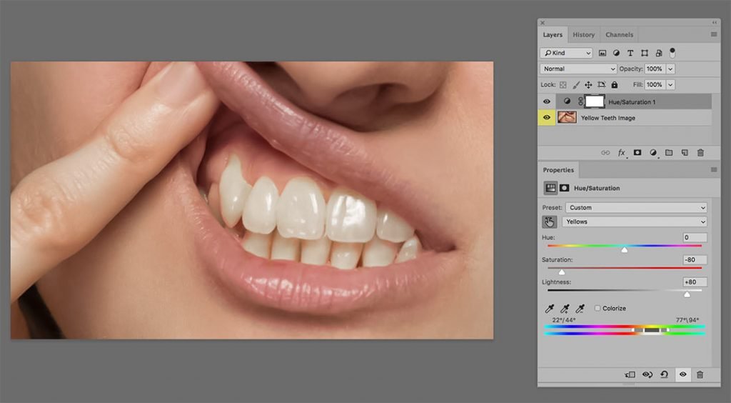 pearly-whites-adobe-photoshop